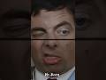 Mr Bean At The Dentist Funniest Comedy Short Ever Shorts Viral Mrbean Viralshorts