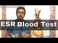 ESR test in Hindi (erythrocyte sedimentation rate test)