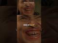 DAVID LYNCH gave Willem Dafoe THESE TEETH…