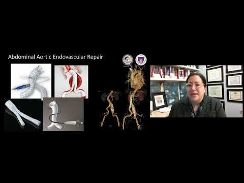 Virtual Summer Conference 2020: Tipos de Complicaciones y sus Investigaciones por la Dr. Sherene Shalhub | Spanish (ES)