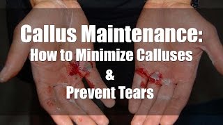 Callus Maintenance: How to Minimize Calluses & Prevent Tears