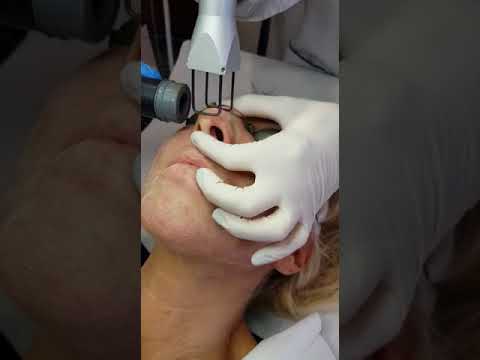 Come ridurre posti di pigmentary da una faccia dopo la consegna La crema contro pigmentary nota una spugna di acqua dolce