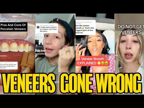 The Dark Side Of Veneers Nobody Talks About