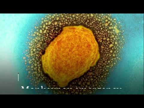 2022 July 24 BBC One minute World News