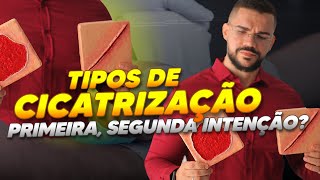 03 TIPOS DE CICATRIZAÇÃO DE FERIDAS QUE VOCÊ PRECISA SABER I Primeira, segunda e terceira intenção