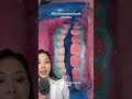 Professional teeth whitening from start to finish. #teethwhitening #whiteteeth #dentist