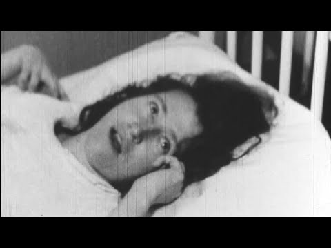 1930's Schizophrenia Treatment | Insulin Shock Therapy and Combined Therapy