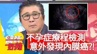 不孕症療程檢測，意外發現內膜癌？！【#醫師好辣】20210503 part2 EP1142 宋明樺 洪素卿