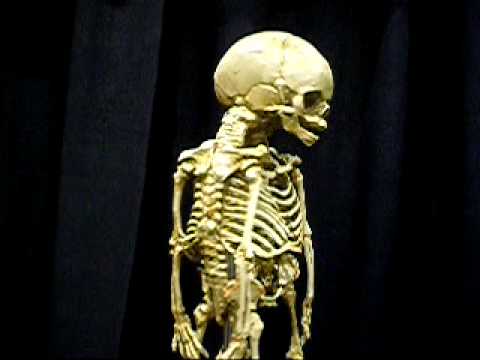 Fetal Oddity Collection - MrSkeleton.com  - single head conjoined