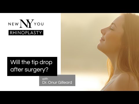 RHINOPLASTY: "Will the Tip Drop After Surgery?", with Dr. Onur Gilleard