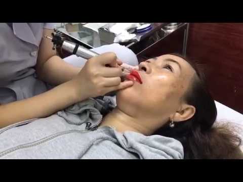 Phun Môi công nghệ Hàn Quốc