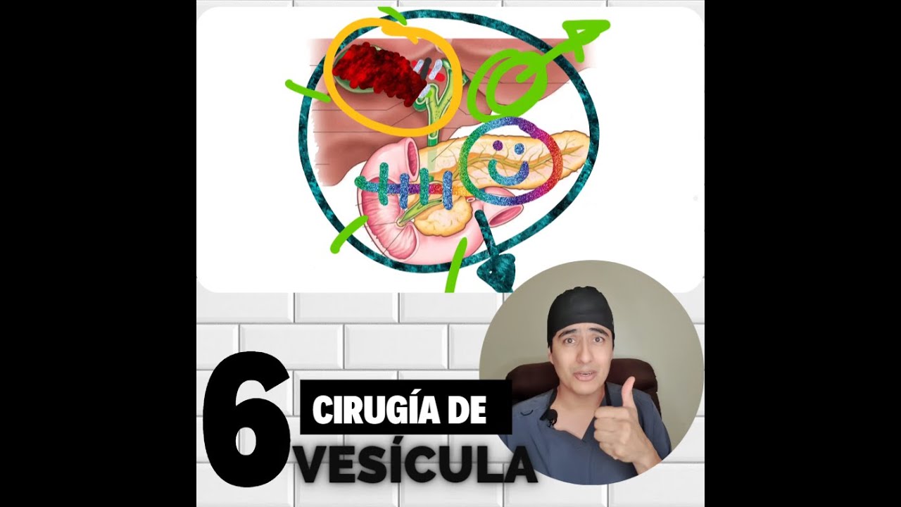 Jorge Alberto Hernández García-3