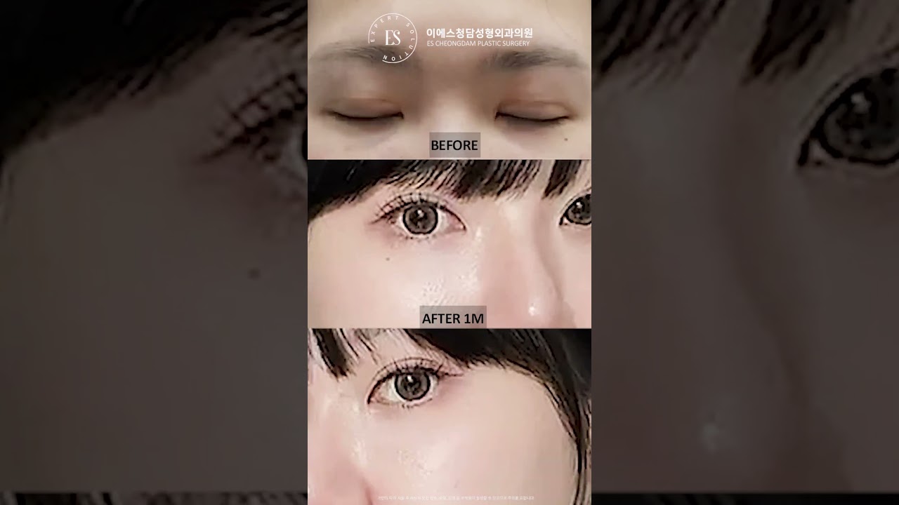 이에스 유튜브