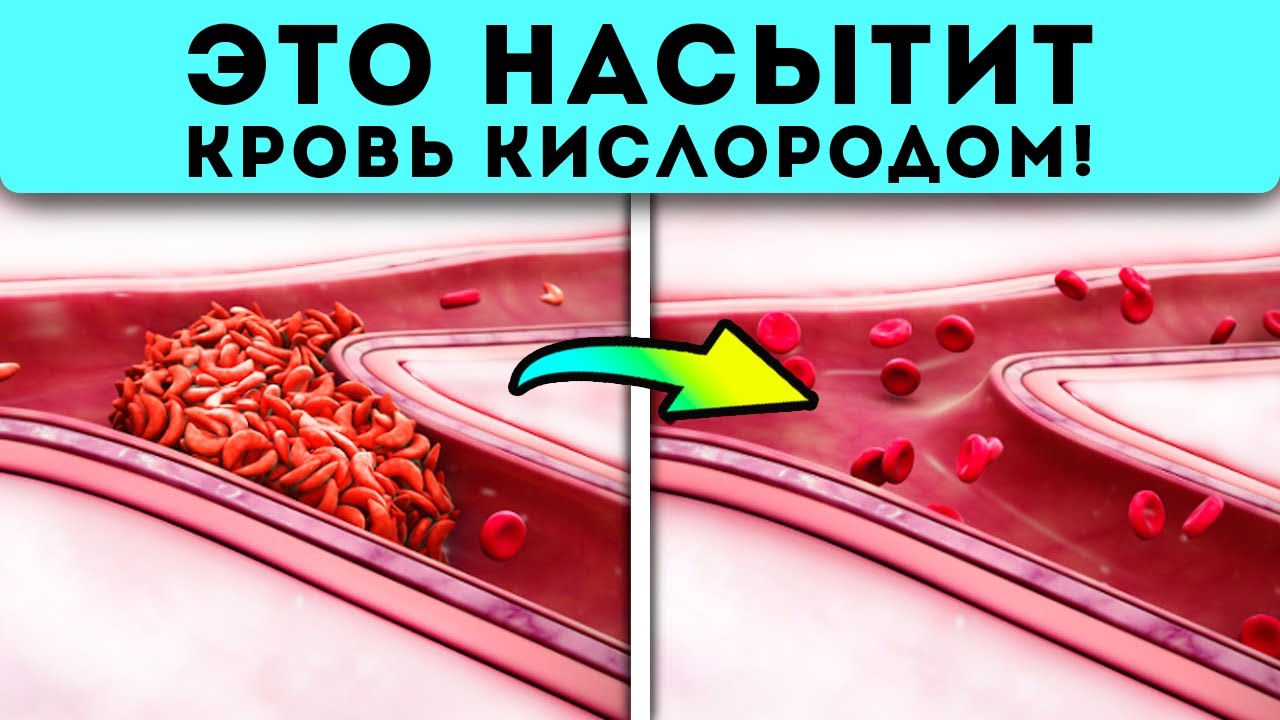 Это на 100% лучше, чем таблетки! Как улучшить состояние крови и насытить кровь кислородом, если...