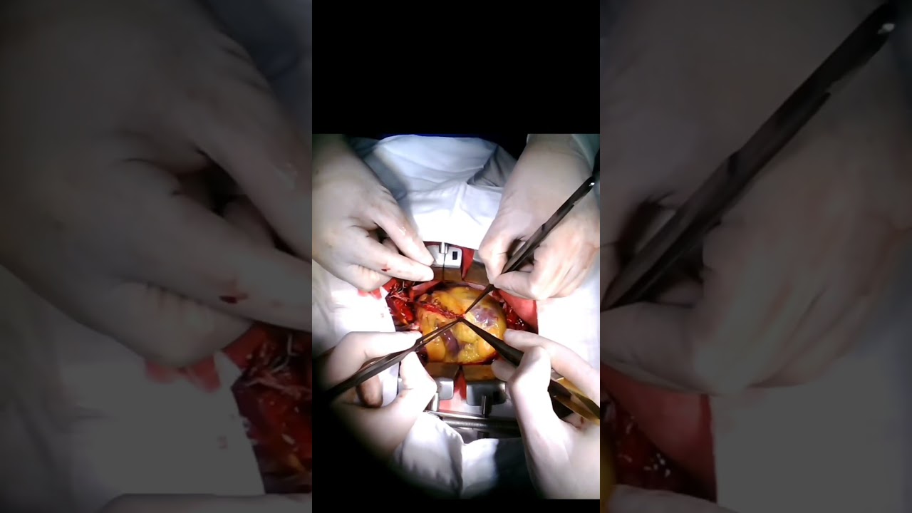 João Victor Ventura De Oliveira-2