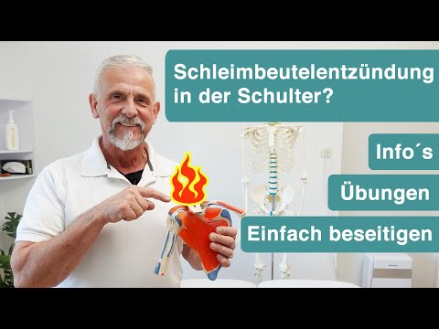 So wirst du deine Schleimbeutelentzündung los ⚡ mit gezielter Kühlung & dem Coolshirt