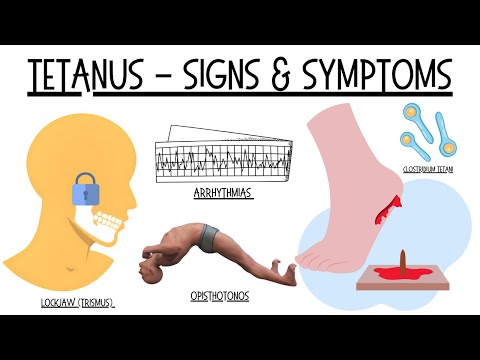 The Danger Of A Rusty Nail - Signs & Symptoms Of Tetanus