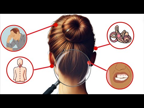 33 HIDDEN Sources of TMJ Dysfunctions