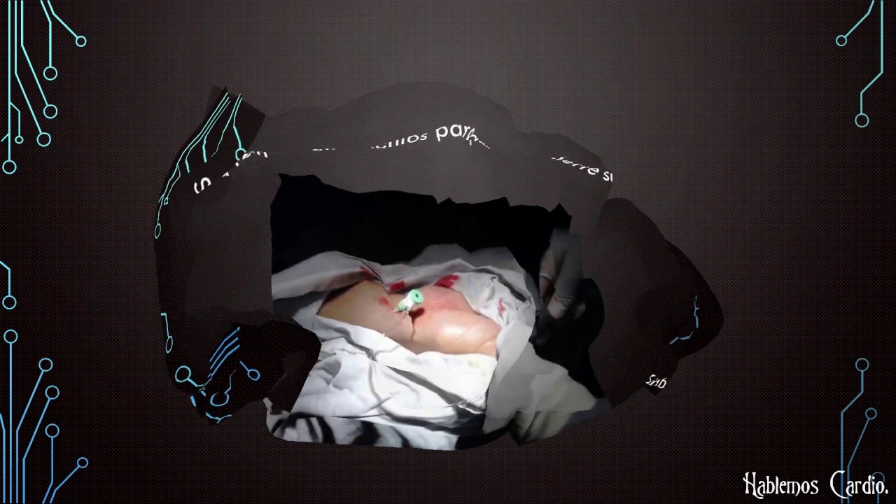 Othniel Cortes Molina-10