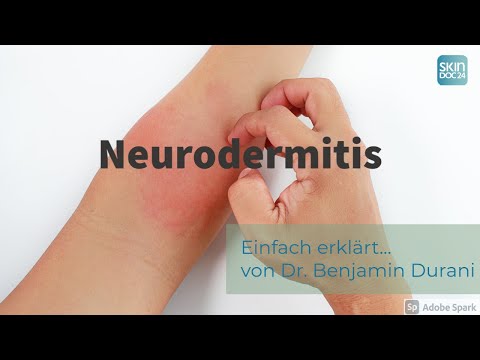 Neurodermitis - Einfach erklärt von Dr. Durani (Facharzt für Haut- und Geschlechtskrankheiten)
