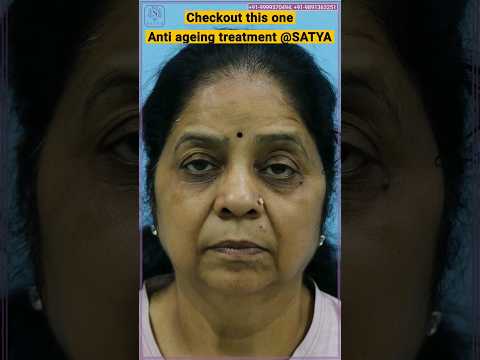 How to look young? | Anti aging treatment | Aging cream | Aging treatment | #youtubeshort #skincare