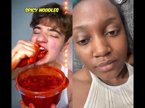 #funny #duet #casualbag #shortvideos #viral #teethdecay #comedy #shorts #trending