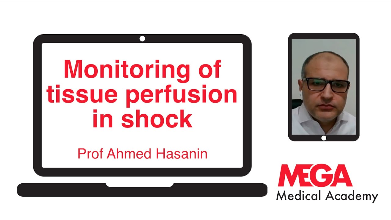 Monitoring of tissue perfusion in shock