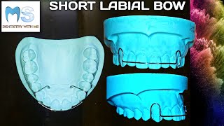 Download lagu Short Labial Bow | how to make Labial Bow | fabrication | Orthodontics | close gap between teeth mp3 Download lagu Short Labial Bow | how to make Labial Bow | fabrication | Orthodontics | close gap between teeth mp3