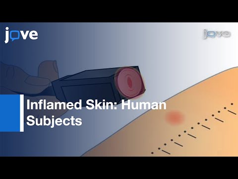Determining Heat & Mechanical Pain Threshold Inflamed Skin: Human Subjects l Protocol Preview