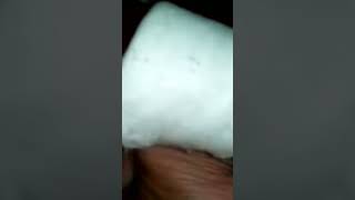 Download lagu Cara Menghilangkan Mata Ikan Di Telapak Kaki #mataikan #sakitkaki mp3