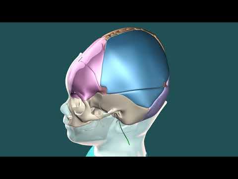 Hydrocephalus Repair