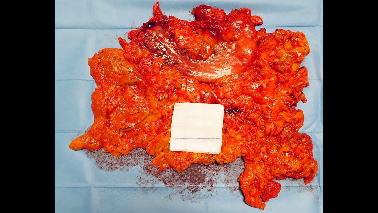 Michał Pędziwiatr-5