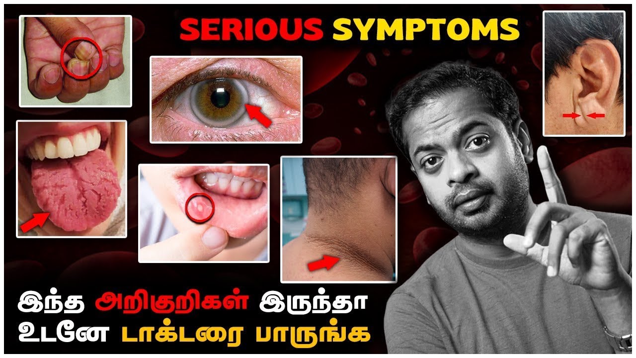 Serious Health Symptoms 😰| Mr.GK