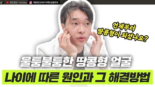 자연스럽게 젊어지고 싶다면? 땅콩형 얼굴 교정!ㅣ디에이성형외과ㅣ디에이성형외과의원
