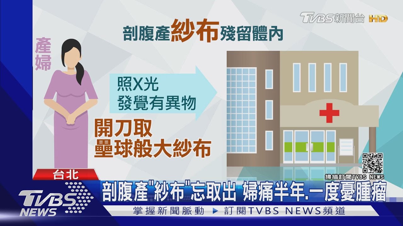 剖腹產「紗布」忘取出 婦痛半年、一度憂腫瘤