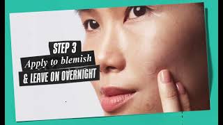 Truly Targeted Overnight Blemish Patch — Targeted Physical