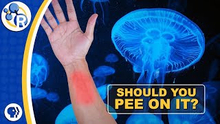Should You Pee on a Jellyfish Sting?