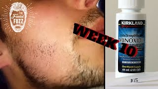 Minoxidil Beard | Week 10 | The Experiment |  #FacialFuzzFridays