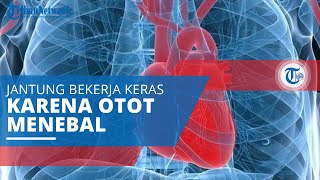 Kardiomiopati, Sebabkan Jantung Bekerja Keras Memompa Darah karena Otot Jantung Menebal dan Kaku