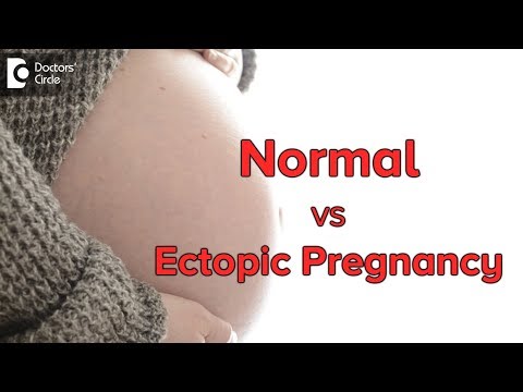 Difference between Ectopic Pregnancy & Normal Pregnancy symptoms - Dr.Archana Kankal of C9 Hospitals