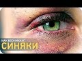 Как возникают синяки? [SLIVKI SHOW] 