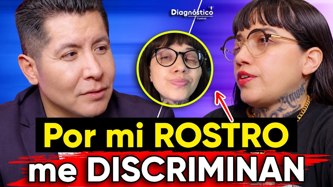 👉🏼Tengo TUMORES en TODO mi CUERPO desde que NACÍ: DAHLIA de la CERDA | #Diagnóstico 198 | Mr Doctor