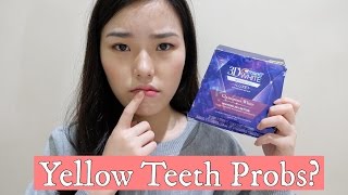 Download lagu HOW I WHITEN MY TEETH AT HOME | Henny Agustin mp3 Download lagu HOW I WHITEN MY TEETH AT HOME | Henny Agustin mp3