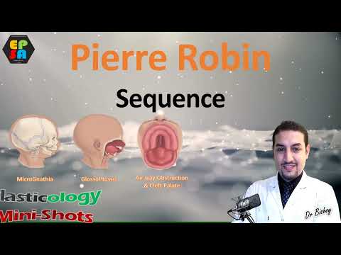 Pierre Robin Sequence - Plasticology Shots