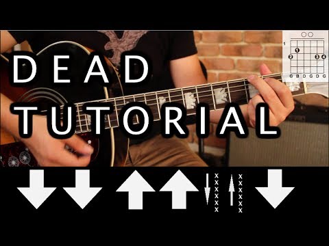 Dead (acoustic) - Zoé