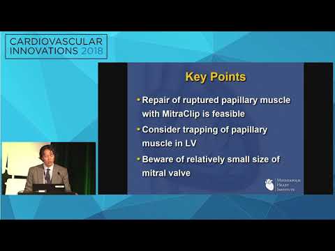 CVI2018 Session: Papillary muscle therapy - Paul Sorajja, MD