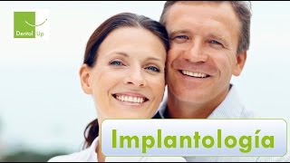 Clíica Dental Up Oferta Implantes - Clínica Dental Up