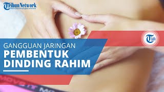 Endometriosis, Kondisi Jaringan Pembentuk Lapisan dalam Dinding Rahim Tumbuh Berada di Luar Rahim