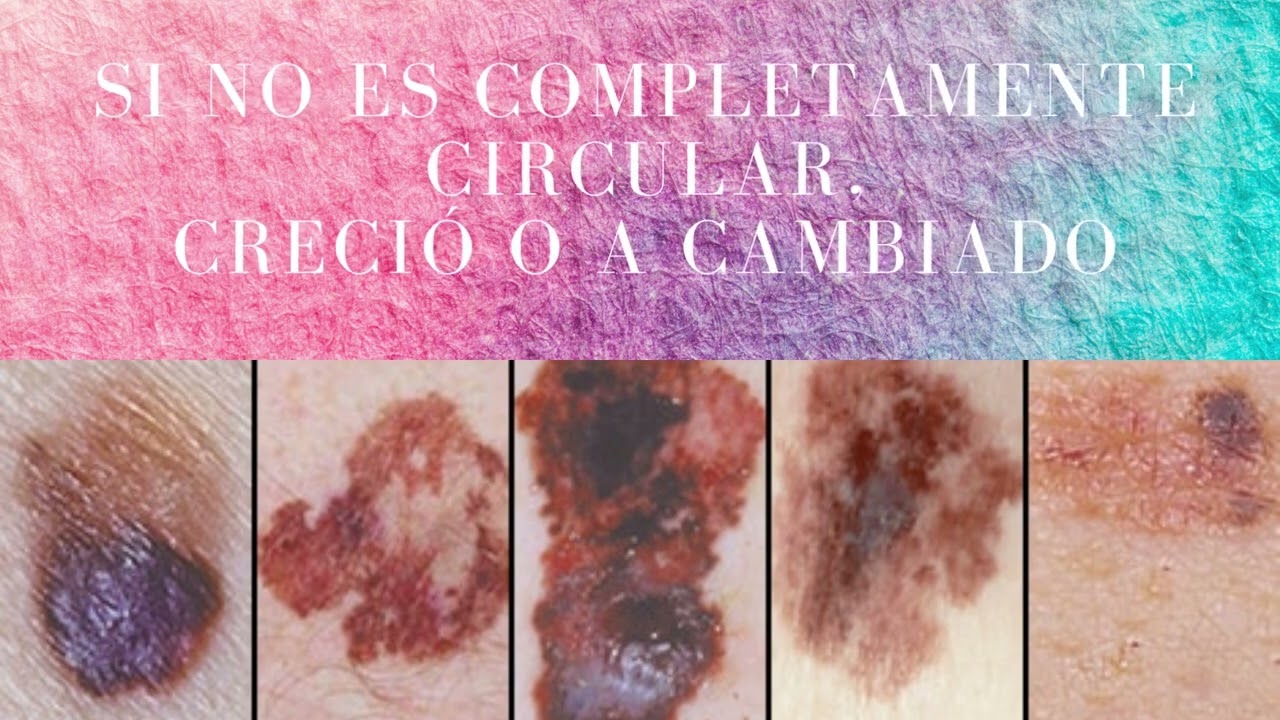 Ricardo Orson Reyna Miramon-11