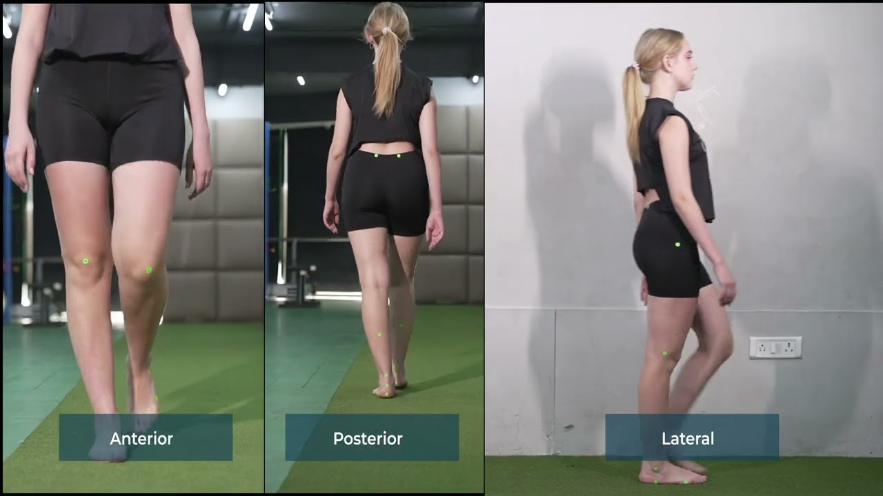 GaitON Gait Analysis